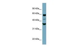 Anti-SEC22C antibody, Internal used in Western Blot (WB). GTX45915