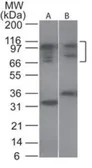 Anti-NFAT2 antibody used in Western Blot (WB). GTX45916
