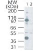 Anti-NFAT2 antibody used in Western Blot (WB). GTX45916