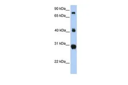 Anti-FIBCD1 antibody, C-term used in Western Blot (WB). GTX45919