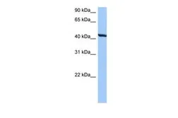Anti-TMEM118 antibody, N-term used in Western Blot (WB). GTX45921