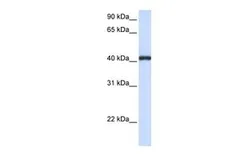 Anti-FCRLM1 antibody, C-term used in Western Blot (WB). GTX45922