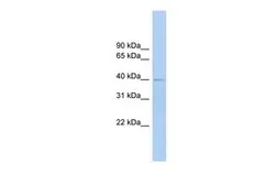 Anti-FCRLM1 antibody, Internal used in Western Blot (WB). GTX45923