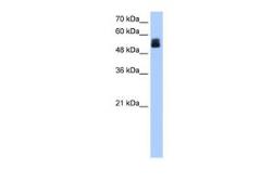 Anti-CRISPLD2 antibody, N-term used in Western Blot (WB). GTX45942