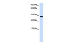 Anti-GLT8D2 antibody, C-term used in Western Blot (WB). GTX45945