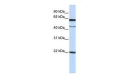 Anti-C6ORF25 antibody, N-term used in Western Blot (WB). GTX45953