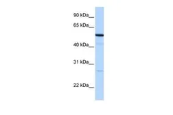 Anti-REEP4 antibody, N-term used in Western Blot (WB). GTX45954