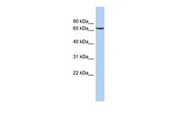 Anti-LRRTM4 antibody, Internal used in Western Blot (WB). GTX45963