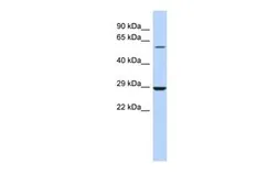 Anti-LPCAT1 antibody, Internal used in Western Blot (WB). GTX45969