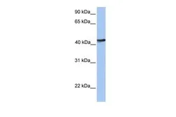 Anti-TMEM149 antibody, N-term used in Western Blot (WB). GTX45979