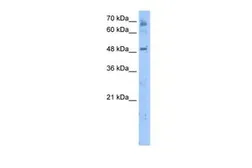 Anti-LENG4 antibody, C-term used in Western Blot (WB). GTX45985