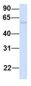 Anti-FAM134A antibody, N-term used in Western Blot (WB). GTX45987