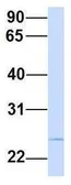 Anti-PRRG3 antibody, N-term used in Western Blot (WB). GTX45989