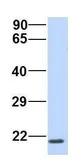 Anti-REEP1 antibody, C-term used in Western Blot (WB). GTX45997
