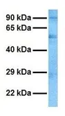Anti-CASD1 antibody, N-term used in Western Blot (WB). GTX45999
