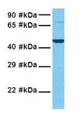 Anti-PORCN antibody, N-term used in Western Blot (WB). GTX46000