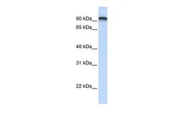 Anti-TMEM168 antibody, C-term used in Western Blot (WB). GTX46011
