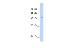 Anti-C11ORF24 antibody, N-term used in Western Blot (WB). GTX46018