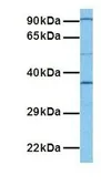 Anti-TNMD antibody, Internal used in Western Blot (WB). GTX46022