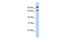 Anti-FAM38B antibody, Internal used in Western Blot (WB). GTX46024