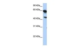 Anti-BAT5 antibody, Internal used in Western Blot (WB). GTX46029