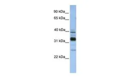 Anti-TXNDC13 antibody, C-term used in Western Blot (WB). GTX46031