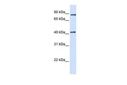 Anti-TXNDC13 antibody, C-term used in Western Blot (WB). GTX46032