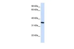 Anti-RTN1 antibody, N-term used in Western Blot (WB). GTX46034