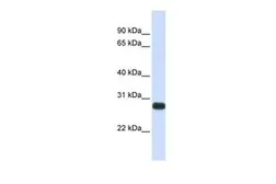 Anti-HAI-2 antibody, Internal used in Western Blot (WB). GTX46036