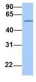Anti-SEMA6D antibody, N-term used in Western Blot (WB). GTX46039