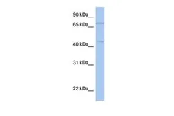 Anti-ISLR2 antibody, N-term used in Western Blot (WB). GTX46040
