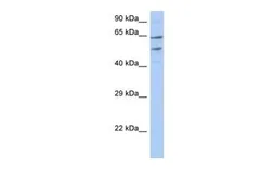 Anti-TMCC3 antibody, N-term used in Western Blot (WB). GTX46046