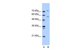 Anti-JPH1 antibody, C-term used in Western Blot (WB). GTX46049