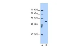 Anti-APMAP antibody, C-term used in Western Blot (WB). GTX46051