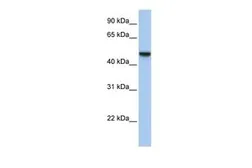 Anti-APMAP antibody, N-term used in Western Blot (WB). GTX46052