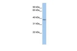 Anti-MFF antibody, C-term used in Western Blot (WB). GTX46061