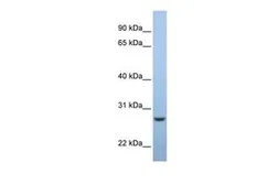 Anti-C15ORF24 antibody, Internal used in Western Blot (WB). GTX46063