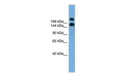 Anti-UGGT1 antibody, Internal used in Western Blot (WB). GTX46065