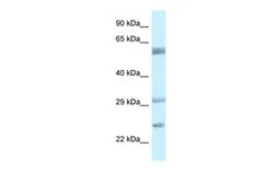 Anti-FLJ20674 antibody, N-term used in Western Blot (WB). GTX46070