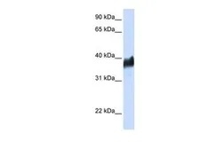 Anti-CLN8 antibody, N-term used in Western Blot (WB). GTX46076