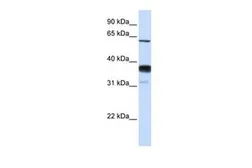 Anti-NSMase2 antibody, Internal used in Western Blot (WB). GTX46086