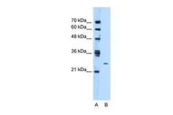 Anti-TMEM126B antibody, Internal used in Western Blot (WB). GTX46089
