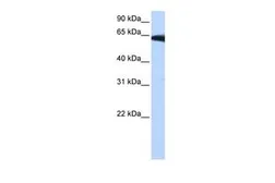 Anti-PIGW antibody, Internal used in Western Blot (WB). GTX46118