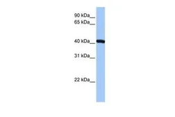 Anti-FTSJ1 antibody, N-term used in Western Blot (WB). GTX46119