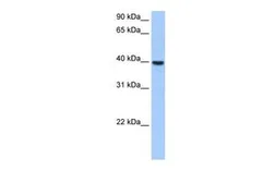 Anti-ST6GALNAC4 antibody, Internal used in Western Blot (WB). GTX46125