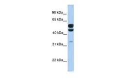 Anti-C3ORF64 antibody, C-term used in Western Blot (WB). GTX46130