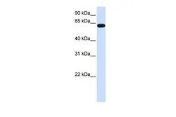 Anti-HS6ST3 antibody, C-term used in Western Blot (WB). GTX46134