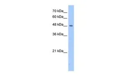 Anti-PNPLA5 antibody, N-term used in Western Blot (WB). GTX46145