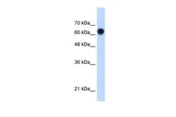 Anti-C3ORF39 antibody, Internal used in Western Blot (WB). GTX46151