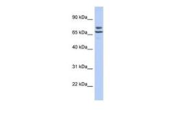 Anti-C3ORF39 antibody, N-term used in Western Blot (WB). GTX46152
